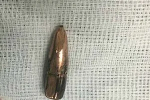 Nhiều người, nhiều nhà bỗng dưng bị trúng đạn lạc