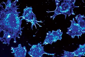 Protein kích thích sự phát triển của khối u ung thư