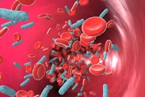 Nhiễm trùng huyết gia tăng ở Anh