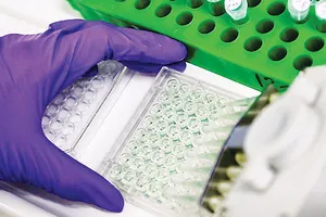 Sản xuất protein bằng… điện