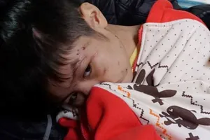 Yêu cầu xử lý nghiêm vụ cháu bé bị bố đẻ và mẹ kế bạo hành