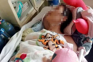 Nữ sinh tái phát tổn thương não sau tai nạn