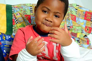 Ghép thành công đôi bàn tay