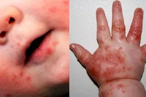 Kiểm tra công tác phòng chống dịch tại bệnh viện