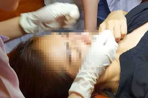 Tăng cường kiểm tra, giám sát các cơ sở thẩm mỹ