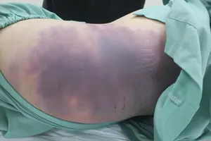 Xin đừng lặng im!