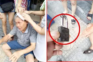 Cụ ông khoảng 70 tuổi bất ngờ bị ổ khóa rơi từ tầng cao chung cư xuống trúng đầu, chảy máu khá nhiều