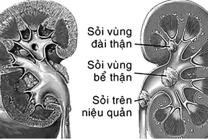 Ảnh minh họa: Nguồn Internet