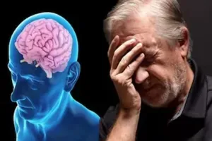 Minh họa về bệnh Alzheimer. Ảnh: THE HEALTH