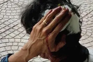 Vụ 2 vợ chồng chém shipper ở Bình Dương: Khởi tố bị can