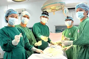Trò chơi mạo hiểm trên khuôn mặt