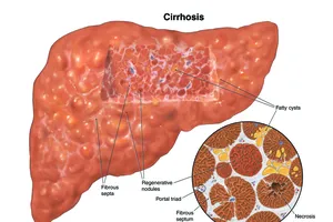 Hình minh họa  (nguồn Internet)
