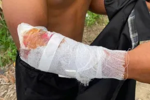 Công an vào cuộc vụ "cá sấu cắn người" ở Khánh Hòa