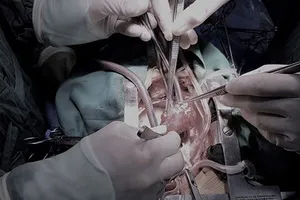 Các bác sỹ đang tiến hành phẫu thuật cho bệnh nhân Xuân. Ảnh: H.Y.