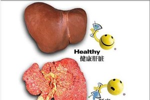 示意圖。（圖片來源：互聯網）