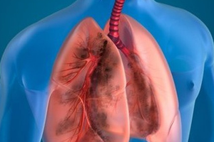 （示意圖源：互聯網）