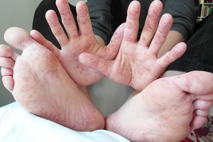 （示意圖源：互聯網）