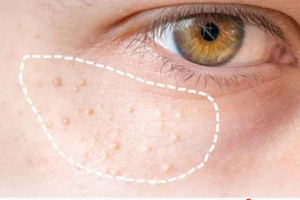 （示意圖源：互聯網） 