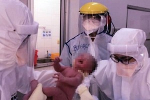 確診產婦安全分娩嬰兒