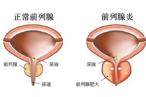 （示意圖源：互聯網）