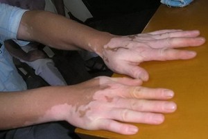 （示意圖源：互聯網）