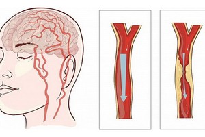 （示意圖：互聯網）