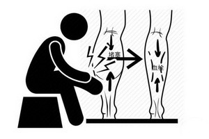（示意圖源：互聯網）
