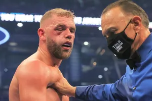 Mắt của Saunders sưng húp khi dính đòn sát thương mạnh