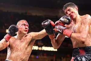 Gương mặt đẫm máu của cả Tim lẫn Fundora