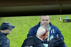 Hình ảnh ông Aguirre chảy máu đầu chụp qua màn hình ti vi