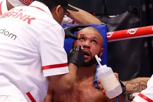 Bác sĩ chăm sóc vết thương cho Eubank Jr