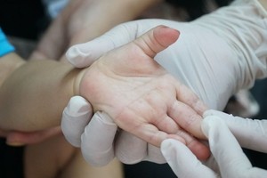 Shortage of intravenous fluids for the treatment of HFMD