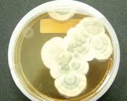 Thành công  nhờ... sự tình cờ