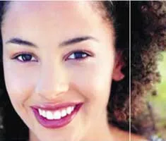 Khắc phục lỗ chân lông to