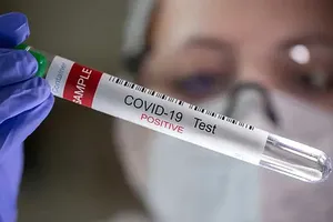 Các dòng phụ BA.4 và BA.5 đang gây ra làn sóng lây nhiễm mới ở nhiều nước