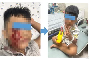 Hiện tình trạng cháu K. cải thiện dần, trẻ được tiếp tục liệu trình tiêm vaccine ngừa dại