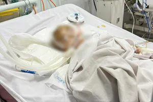 Điều tra vụ bé trai xuất huyết não bất thường tại một điểm giữ trẻ tự phát