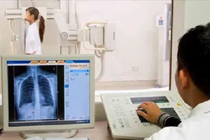 Đề nghị không áp dụng thông số thời gian chụp X-quang để thanh toán BHYT