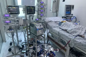 Tác nhân phổ biến nhất gây viêm màng não vi khuẩn ở trẻ nhỏ
