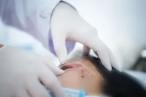 Tai nạn giao thông trên đường hành hương, 4 người bị thương nặng