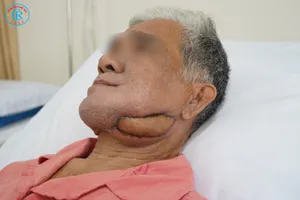 Phẫu thuật tạo hình giúp người bệnh thoát khỏi mặc cảm