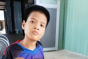 Cháu bé bị bại não, liệt toàn thân