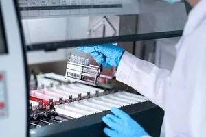 Sàng lọc sức khỏe diện rộng: Bài toán năng lực phòng xét nghiệm