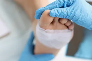 Đột phá trong điều trị vết thương lâu lành