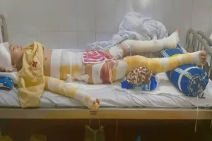 Cháu trai bị bỏng nặng không có tiền chữa trị
