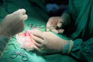 Các bác sĩ thực hiện kỹ thuật hỗ trợ sinh sản. Ảnh: Bệnh viện Việt – Bỉ 
