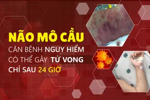Não mô cầu – Căn bệnh nguy hiểm có thể gây tử vong chỉ sau 24 giờ