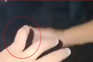 Vụ chủ quán cơm tấn công khách: UBND huyện Phù Mỹ chỉ đạo xác minh, xử lý nghiêm