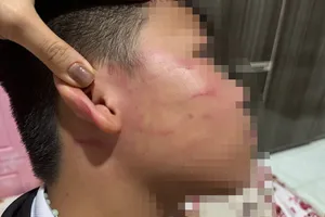 Vụ học sinh lớp 4 bị tát ở Gia Lai: Điểm dạy thêm hoạt động không phép