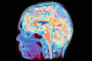 Phát hiện não người phát triển từ hai hệ tế bào riêng biệt